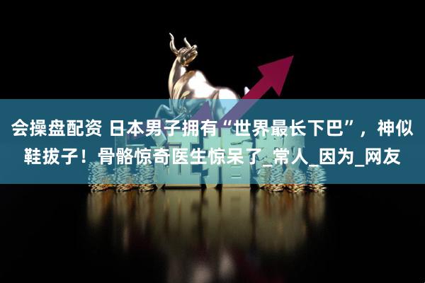 会操盘配资 日本男子拥有“世界最长下巴”，神似鞋拔子！骨骼惊奇医生惊呆了_常人_因为_网友